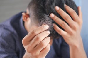 Saç Dökülmesini Önlemek İçin Etkisi Kanıtlanmış 3 Ev Çözümü